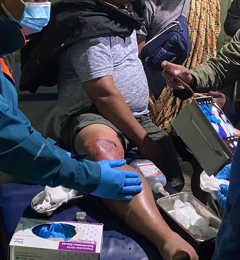 Warga Sipil Ditembak di Kampung Kago, Puncak