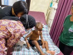 Bocah 5 Tahun jadi Korban Penganiayaan Pasutri di Padang Bulan